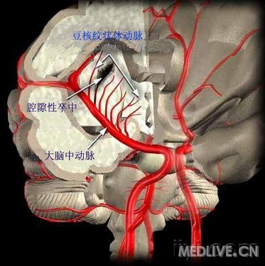 http://webres.medlive.cn/upload/000/006/461