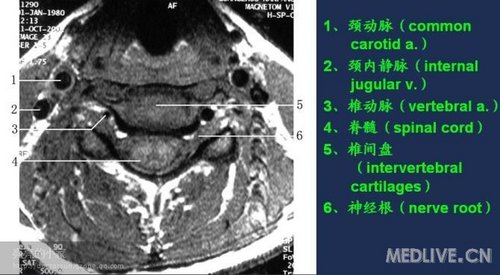 http://webres.medlive.cn/upload/000/006/479