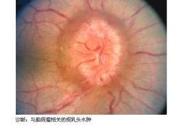 http://webres.medlive.cn/upload/000/007/279