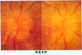 http://webres.medlive.cn/upload/000/007/284