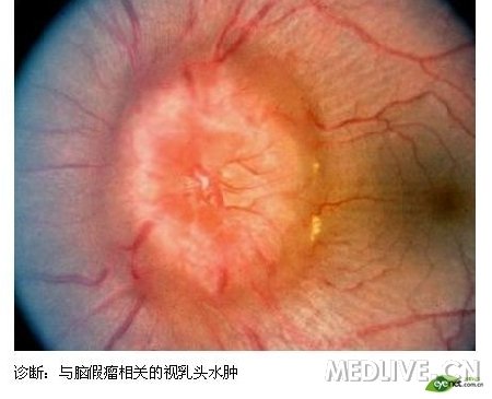 http://webres.medlive.cn/upload/000/007/287