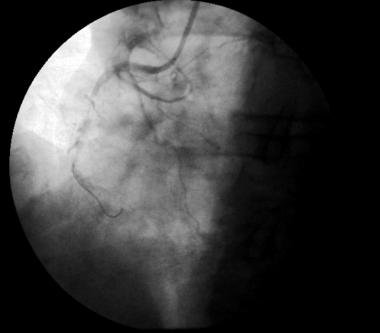 http://webres.medlive.cn/upload/000/008/235