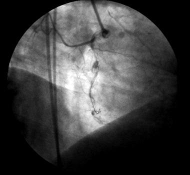 http://webres.medlive.cn/upload/000/008/236