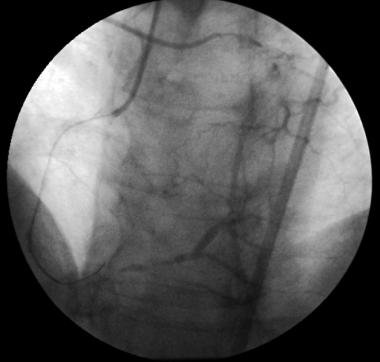 http://webres.medlive.cn/upload/000/008/241