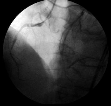 http://webres.medlive.cn/upload/000/008/244