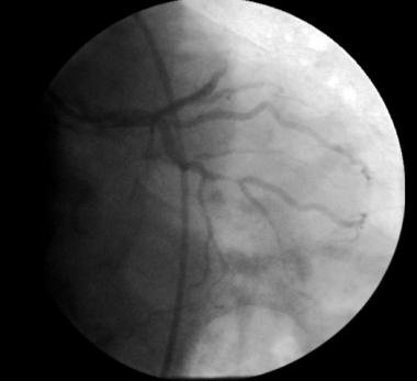 http://webres.medlive.cn/upload/000/008/251