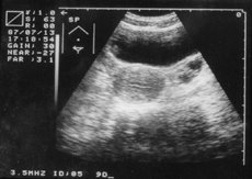 http://webres.medlive.cn/upload/000/010/798