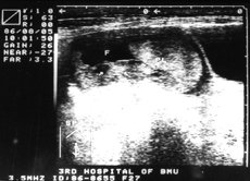 http://webres.medlive.cn/upload/000/010/814