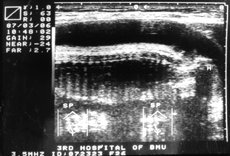 http://webres.medlive.cn/upload/000/010/816