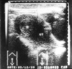 http://webres.medlive.cn/upload/000/010/821