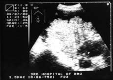 http://webres.medlive.cn/upload/000/010/822