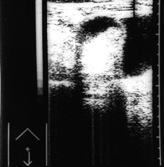 http://webres.medlive.cn/upload/000/010/826