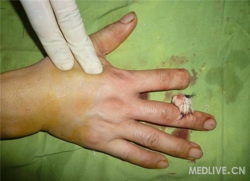 http://webres.medlive.cn/upload/000/010/891