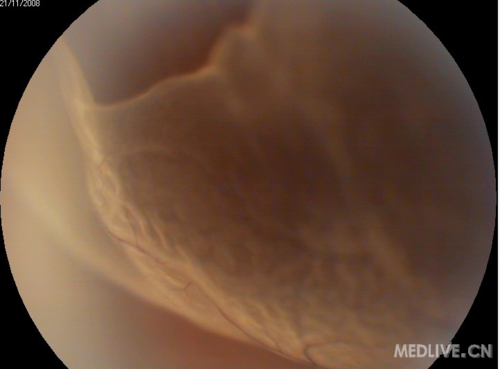 http://webres.medlive.cn/upload/000/011/107