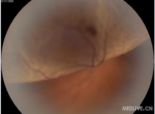http://webres.medlive.cn/upload/000/011/108