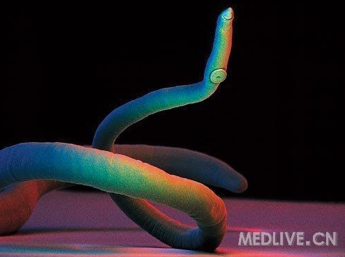 http://webres.medlive.cn/upload/000/012/650