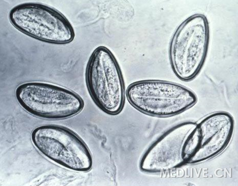 http://webres.medlive.cn/upload/000/012/652