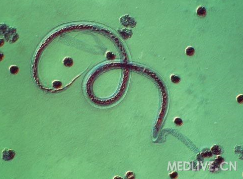 http://webres.medlive.cn/upload/000/012/653