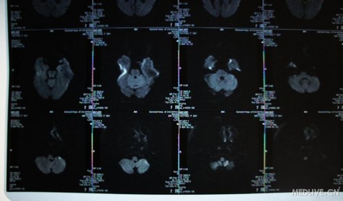 http://webres.medlive.cn/upload/000/012/774