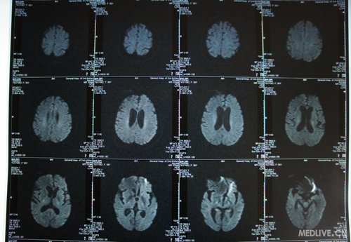 http://webres.medlive.cn/upload/000/012/779