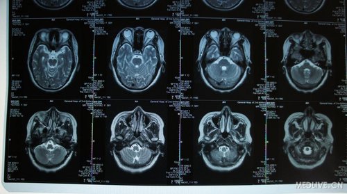 http://webres.medlive.cn/upload/000/012/781