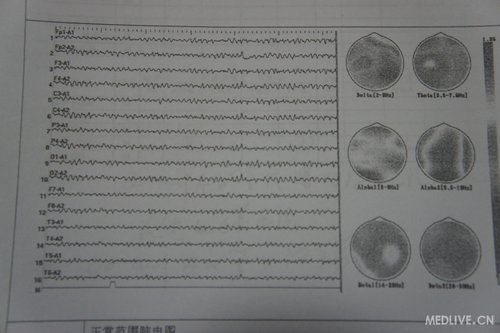 http://webres.medlive.cn/upload/000/012/784