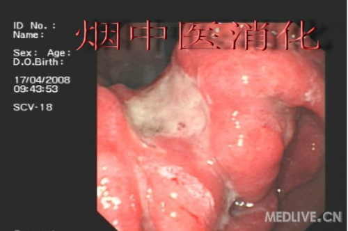 http://webres.medlive.cn/upload/000/014/016