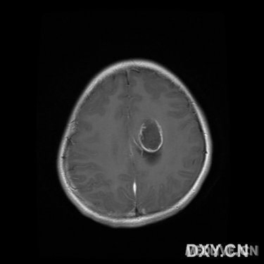 http://webres.medlive.cn/upload/000/016/330