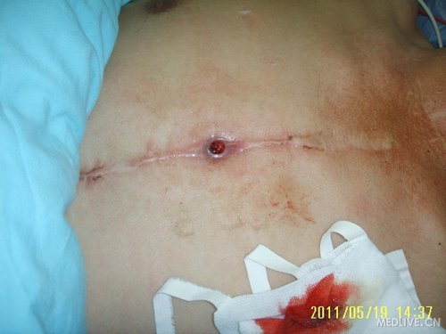 http://webres.medlive.cn/upload/000/018/261