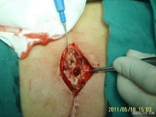 http://webres.medlive.cn/upload/000/018/262