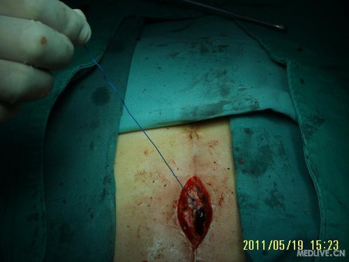 http://webres.medlive.cn/upload/000/018/266