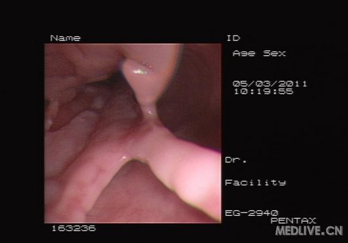http://webres.medlive.cn/upload/000/019/821