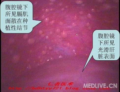 http://webres.medlive.cn/upload/000/024/694
