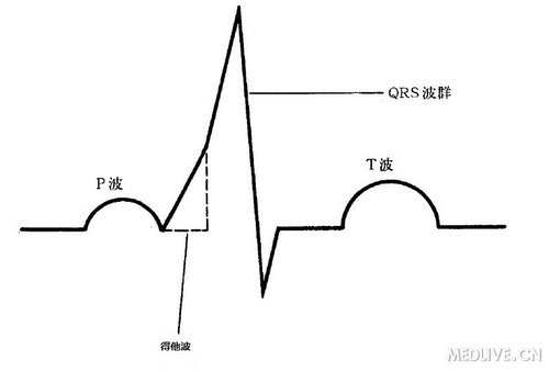 心电图从头开始学从此不用死记硬背