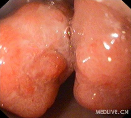 http://webres.medlive.cn/upload/000/038/334