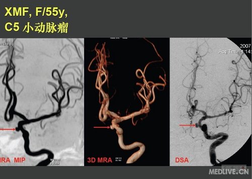 http://webres.medlive.cn/upload/000/038/988