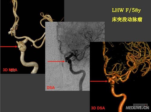 http://webres.medlive.cn/upload/000/038/992