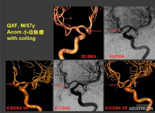 http://webres.medlive.cn/upload/000/038/994