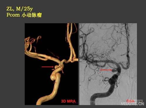 http://webres.medlive.cn/upload/000/038/996