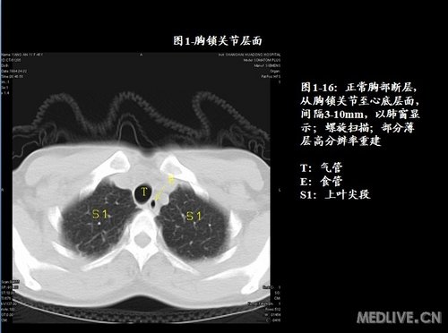 http://webres.medlive.cn/upload/000/041/486