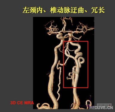 http://webres.medlive.cn/upload/000/041/507