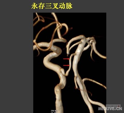 http://webres.medlive.cn/upload/000/041/508