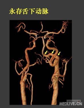 http://webres.medlive.cn/upload/000/041/511