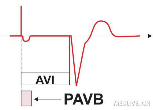 http://webres.medlive.cn/upload/000/042/403