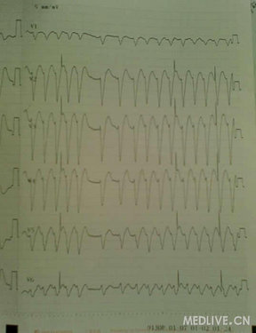 http://webres.medlive.cn/upload/000/042/539