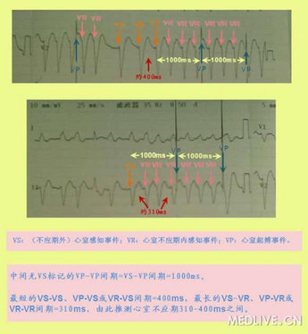 http://webres.medlive.cn/upload/000/042/543