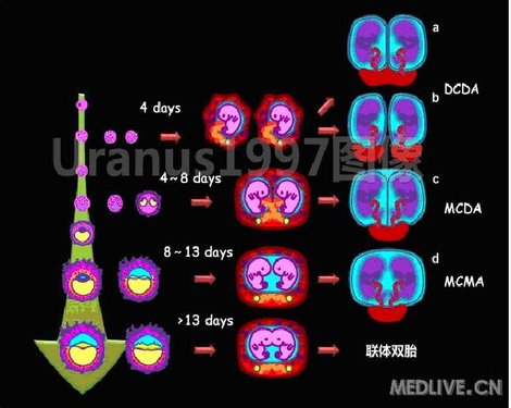 http://webres.medlive.cn/upload/000/046/736