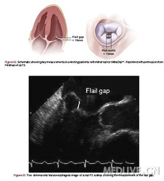 http://webres.medlive.cn/upload/000/047/621