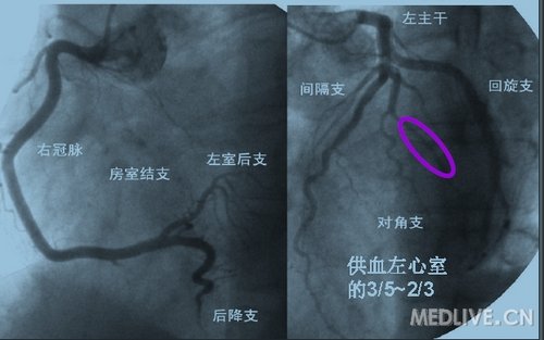 http://webres.medlive.cn/upload/000/048/178