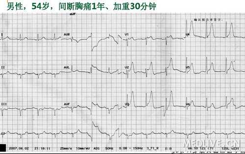 http://webres.medlive.cn/upload/000/048/179